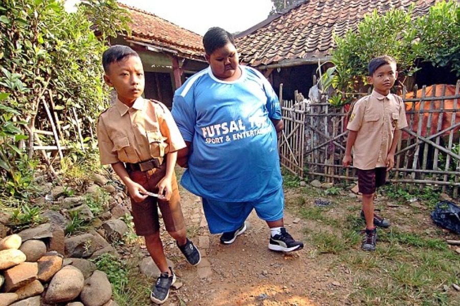 Το πιο χοντρό παιδί του κόσμου έχασε 106 κιλά και ζει πλέον μια φυσιολογική ζωή 3