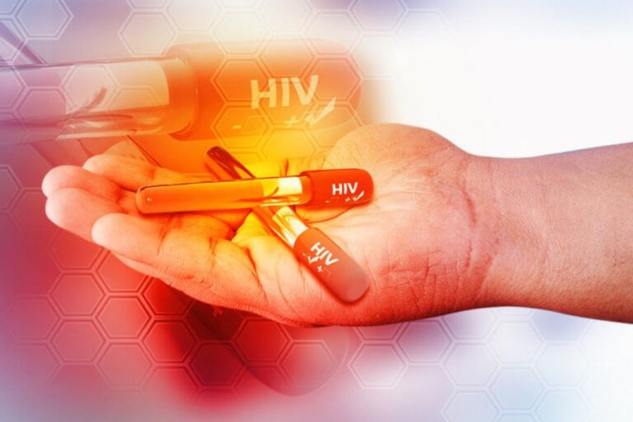 AIDS: Τέλος στην μετάδοση του ιού HIV από τον ένα ασθενή στον άλλο 8