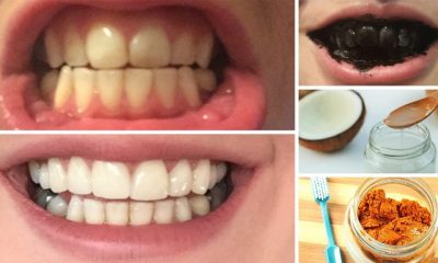 8 φυσικοί τρόποι για λεύκανση δοντιών στο σπίτι σε 3 λεπτά 5