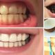 8 φυσικοί τρόποι για λεύκανση δοντιών στο σπίτι σε 3 λεπτά 11