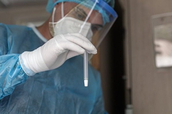 Κορονοϊός: 66 νεκροί και 476 νέα κρούσματα σήμερα 28/12 3