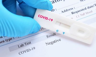 3.000 rapid test από την Περιφέρεια για έλεγχο κορονοϊού σε αθλητές ομαδικών αθλημάτων 10