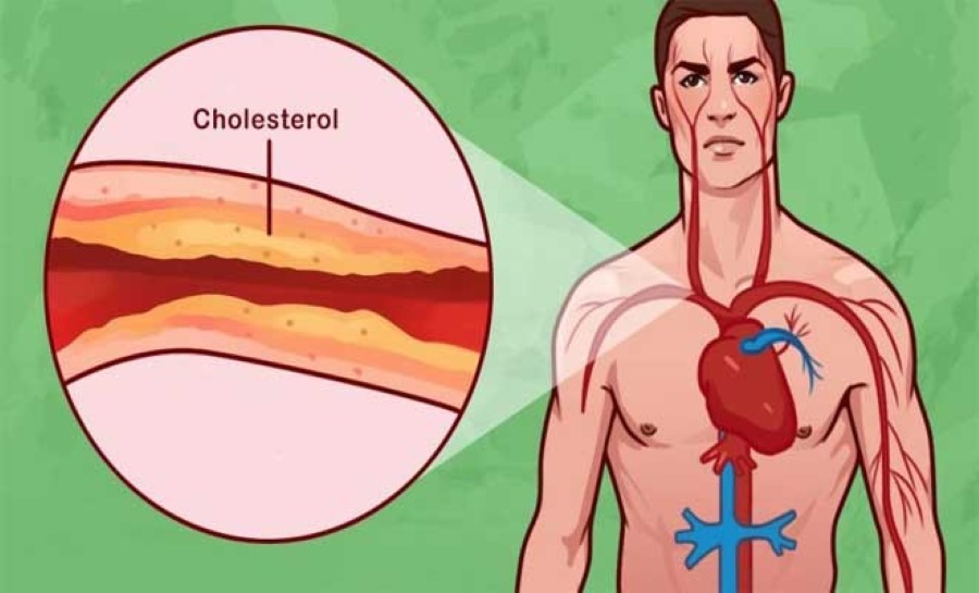 8 εκπληκτικοί τρόποι για την καταπολέμηση της χοληστερίνης και της υψηλής πίεσης του αίματος 1