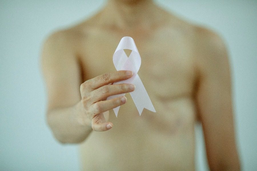 το 2020 διαγνώστηκαν 40% λιγότεροι καρκίνοι και αυτό θα είναι καταστροφικό για κάποιους ασθενείς 1