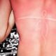 9 οδηγίες αντιμετώπισης για την ανακούφιση του δέρματος από το Ηλιακό έγκαυμα 22