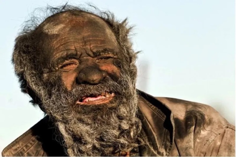 Ο «πιο βρόμικος άνθρωπος στον κόσμο» πέθανε σε ηλικία 94 ετών - Είχε να πλυθεί πάνω από 50 χρόνια 3