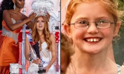 Όταν ήταν μικρή ήταν θύμα bullying, σήμερα είναι η Μις Αγγλία 2022 24
