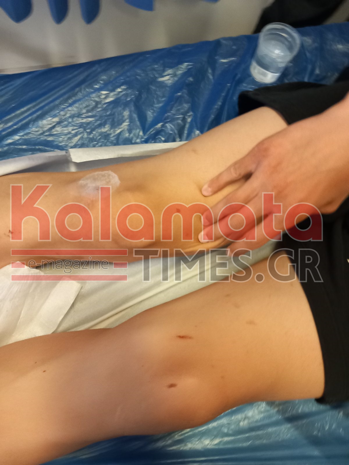 Ξεφεύγει η βία με ανήλικους στην Καλαμάτα… άγριος ξυλοδαρμός 16χρονου! 9