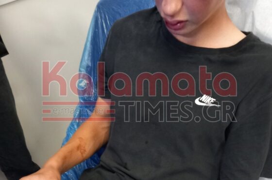 Ξεφεύγει η βία με ανήλικους στην Καλαμάτα… άγριος ξυλοδαρμός 16χρονου!