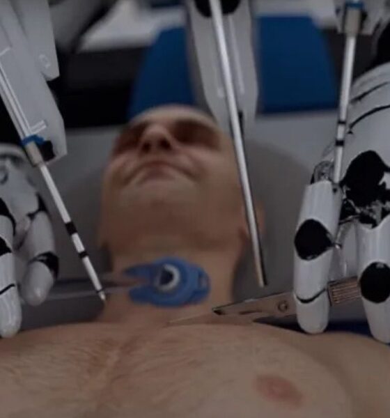 Το ρομπότ που θα κάνει μεταμόσχευση κεφαλιού ‑ Τρομακτικό βίντεο δείχνει τη διαδικασία 81