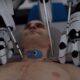 Το ρομπότ που θα κάνει μεταμόσχευση κεφαλιού ‑ Τρομακτικό βίντεο δείχνει τη διαδικασία 69