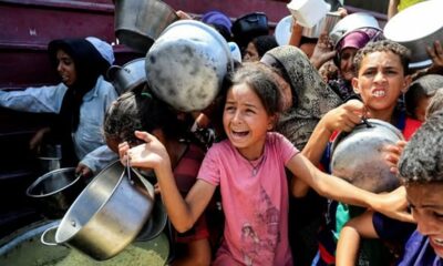 Ανοικτή επιστολή - Τα παιδιά της Γάζας λιμοκτονούν 9